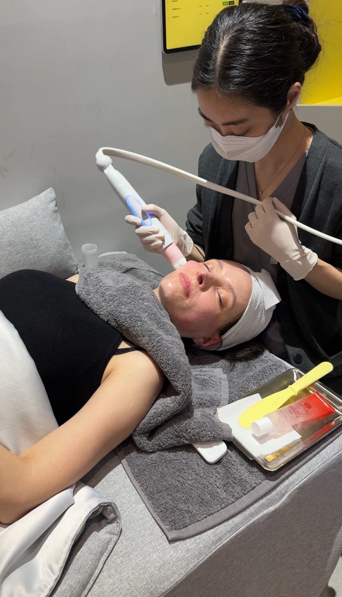 Hyperhidrosis Botox